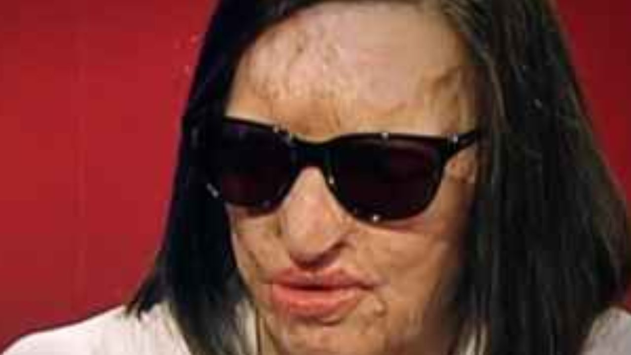 Filomena Lamberti è lei la prima donna sfigurata con l'acido dal marito -  Notizie.com