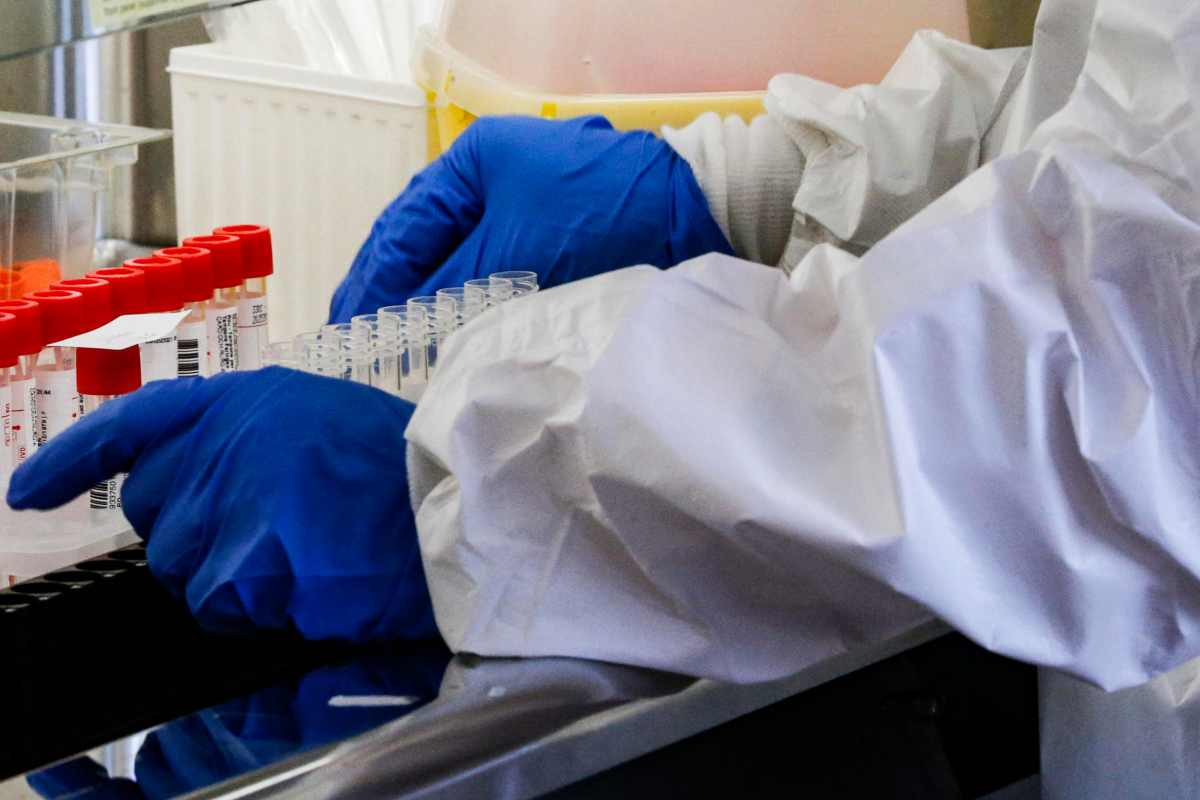 Verme nel cervello durante risonanza