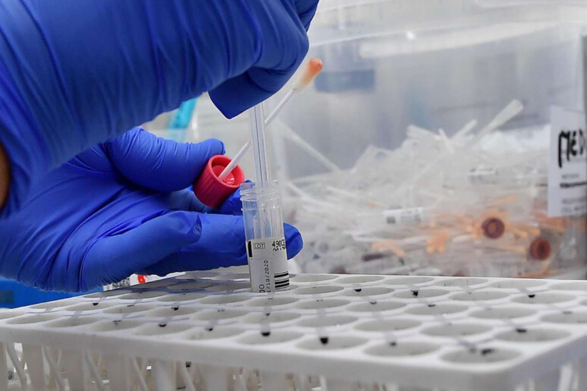 Scoperta proteina che predice cancro 
