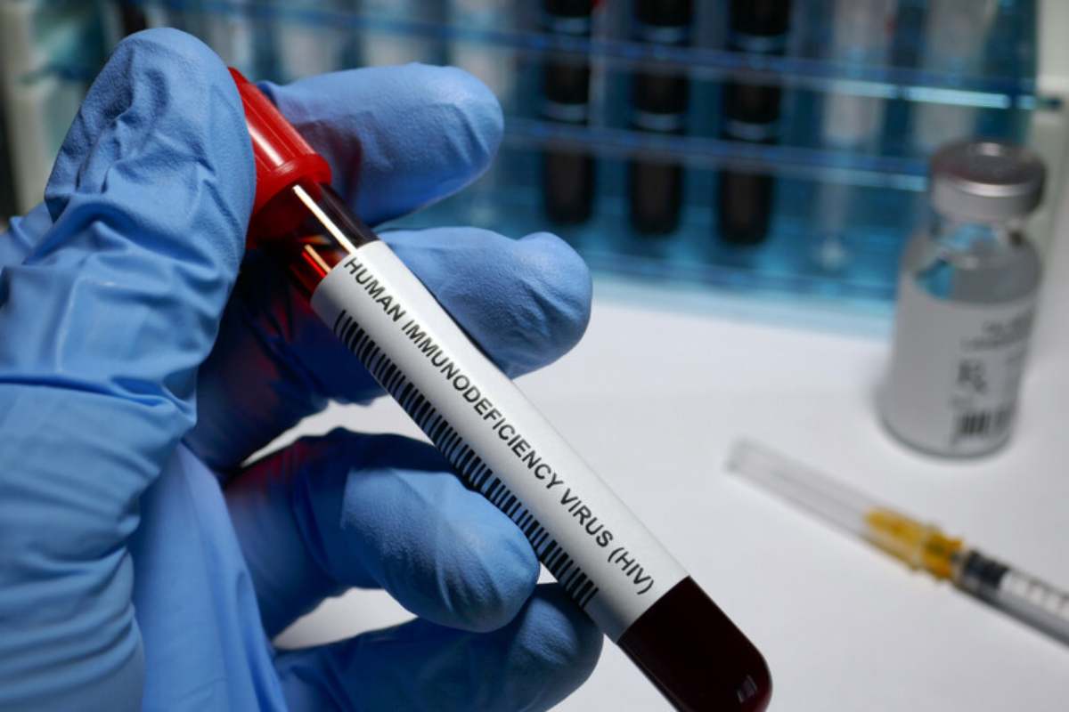 Aids ancora tanti casi