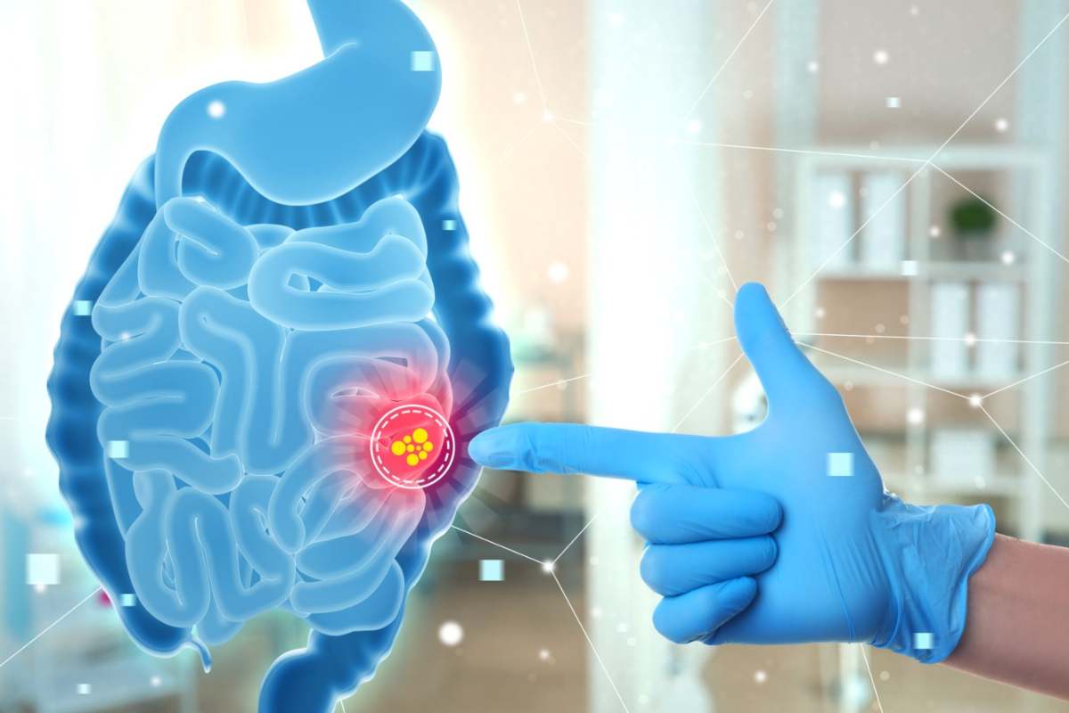 microbiota intestinale immunità 