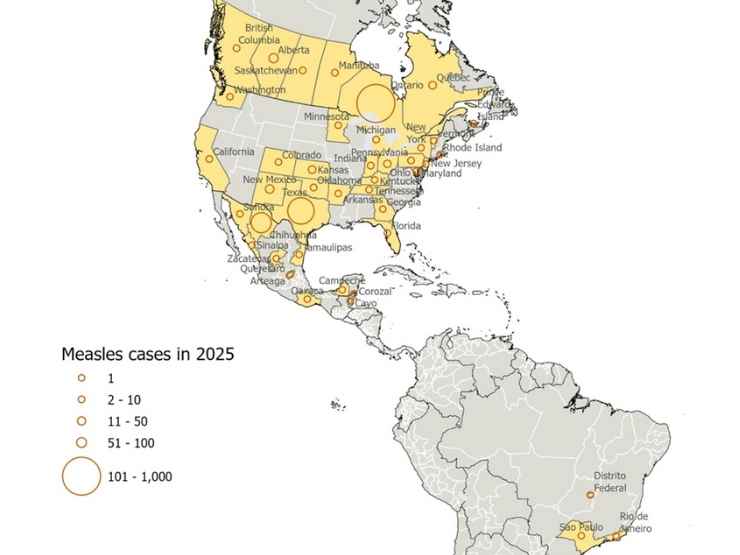 Rischio morbillo Americhe
