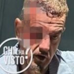 Francis Kaufmann ferito alla testa