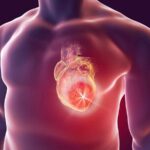 Malattie cardiovascolari