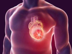 Malattie cardiovascolari