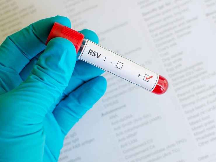 Virus sinciziale 