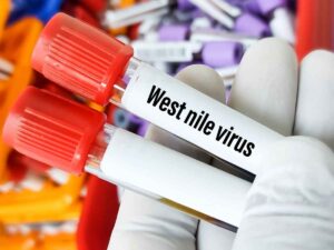 Provette di campioni del virus West Nile