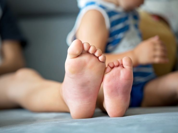 Il piede gonfio di un bambino dopo la puntura di una vespa