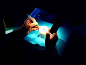 Trapianto di cornea, quattro donazioni dalla Campania