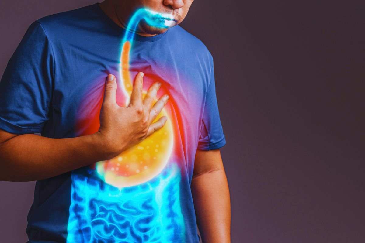 il reflusso peggiora in estate il motivo e la soluzione