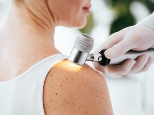 Visita dermatologica per la mappatura dei nei