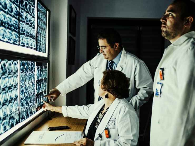 Medici che studiano i disturbi neurologici