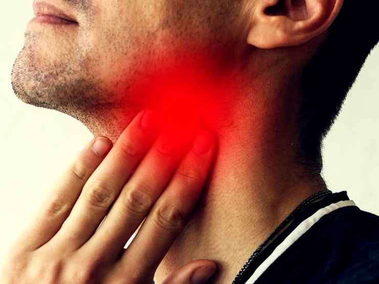 Irritazione alla gola