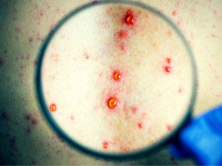 Le infezioni tra le cause della mortalità infantile