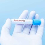 Hantavirus, allarme in Italia