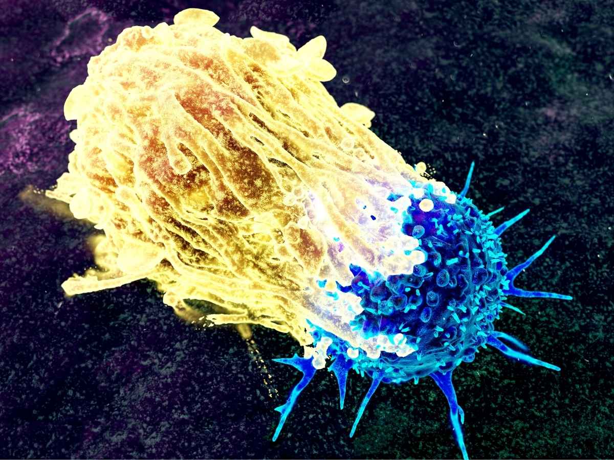 Cancro al pancreas