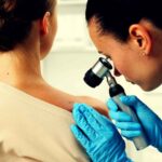 Lo studio sul melanoma