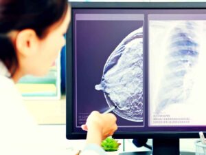 Diagnosi di cancro